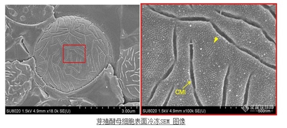 芽殖酵母細胞表面冷凍SEM 圖像 芽殖酵母細胞表面冷凍SEM 圖像